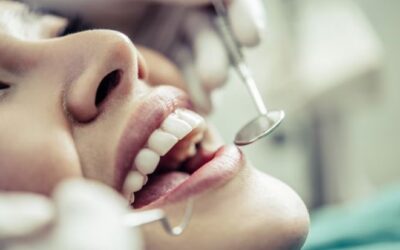 Descubre la Estética Dental: Cómo conseguir una sonrisa perfecta