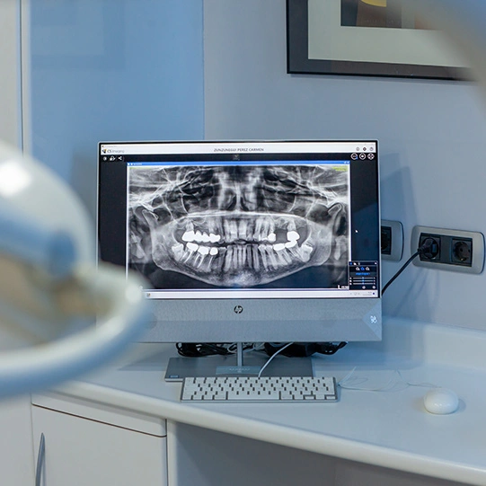 Tecnologia e Innovacion en Clinica Dental Madrid Tecnologia e Innovacion en Clinica Dental Madrid