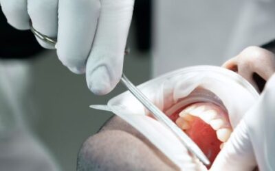 Cirugía oral: todo lo que necesitas saber antes de pasar por quirófano dental
