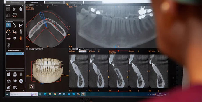 Cirugía oral Madrid 