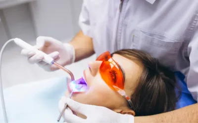 ¿Cuánto dura el blanqueamiento dental realmente?