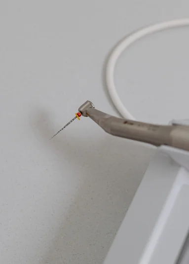 endodoncia en madrid endodoncia en madrid
